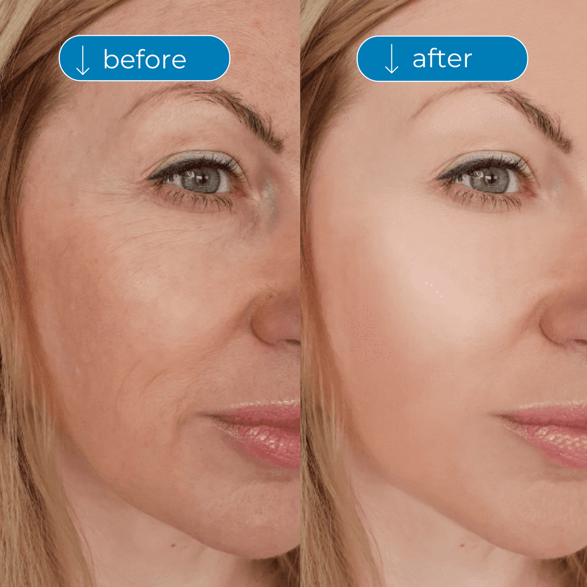 Collagen Peptides
