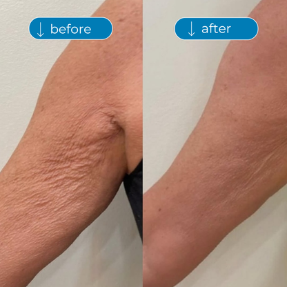 Collagen Peptides