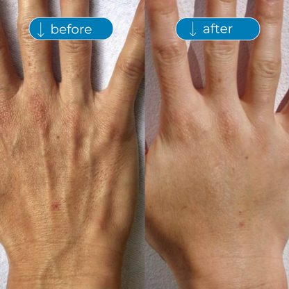 Collagen Peptides